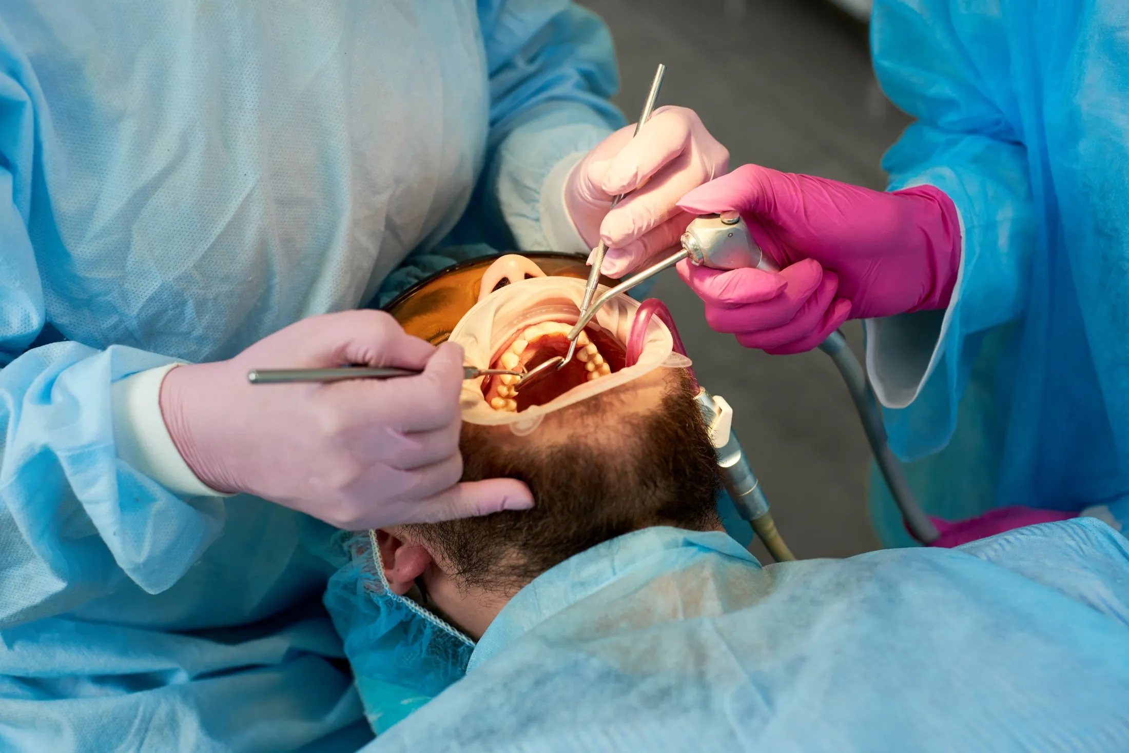 Oral and maxillofacial surgeon performing a precise surgical procedure inside a patient’s mouth using specialized instruments.
