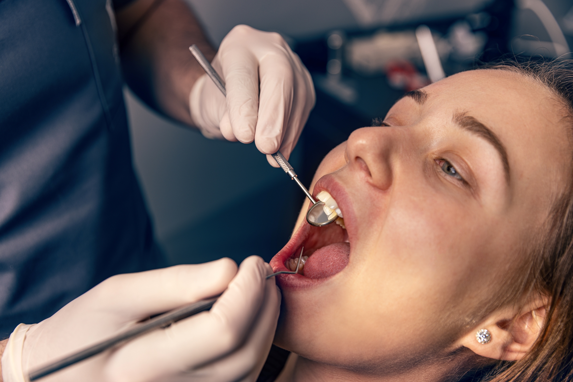 Oral surgeon examining a patient’s mouth with dental instruments during a careful clinical evaluation.