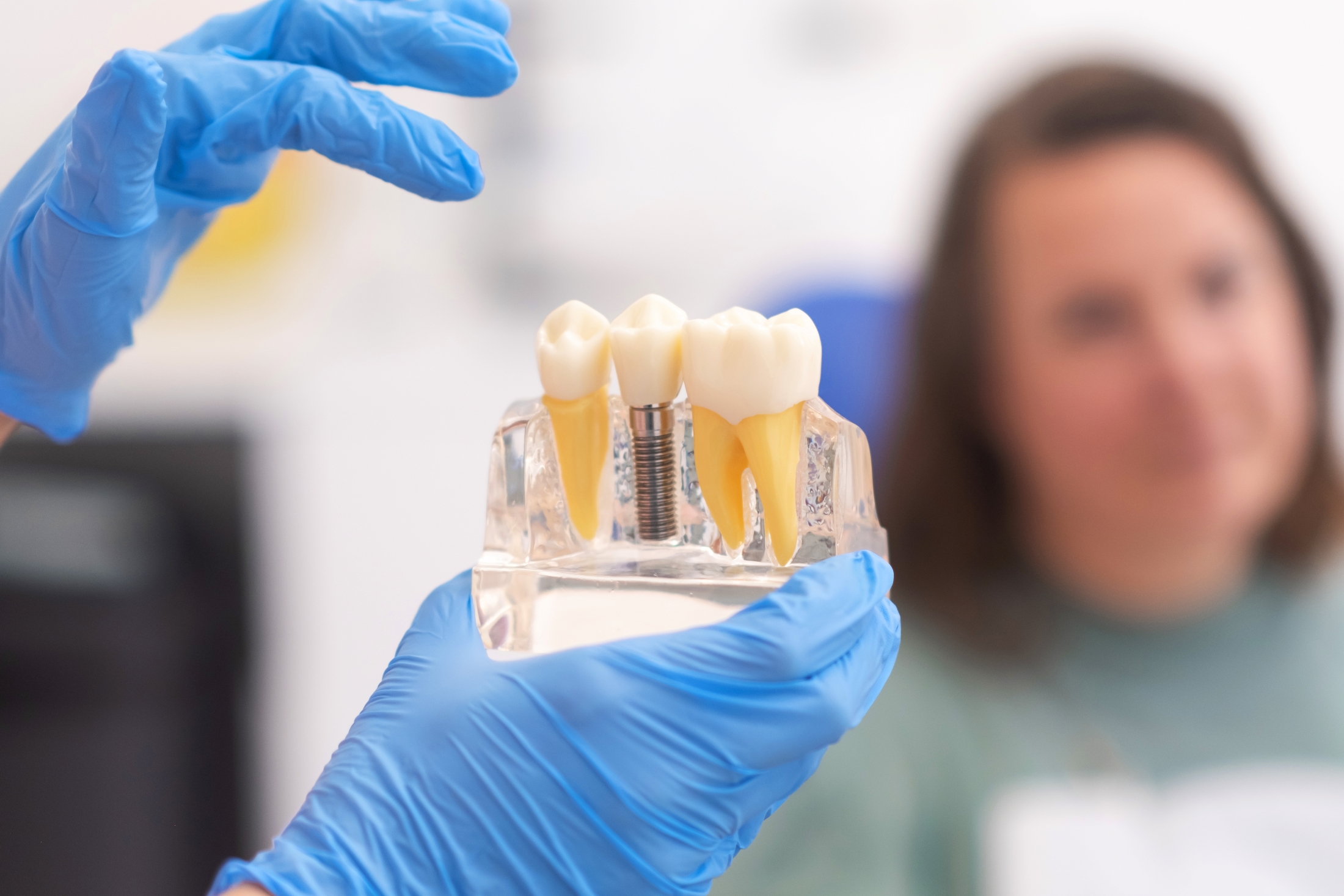 An experienced dentist holding a dental implant model at Premier Oral.