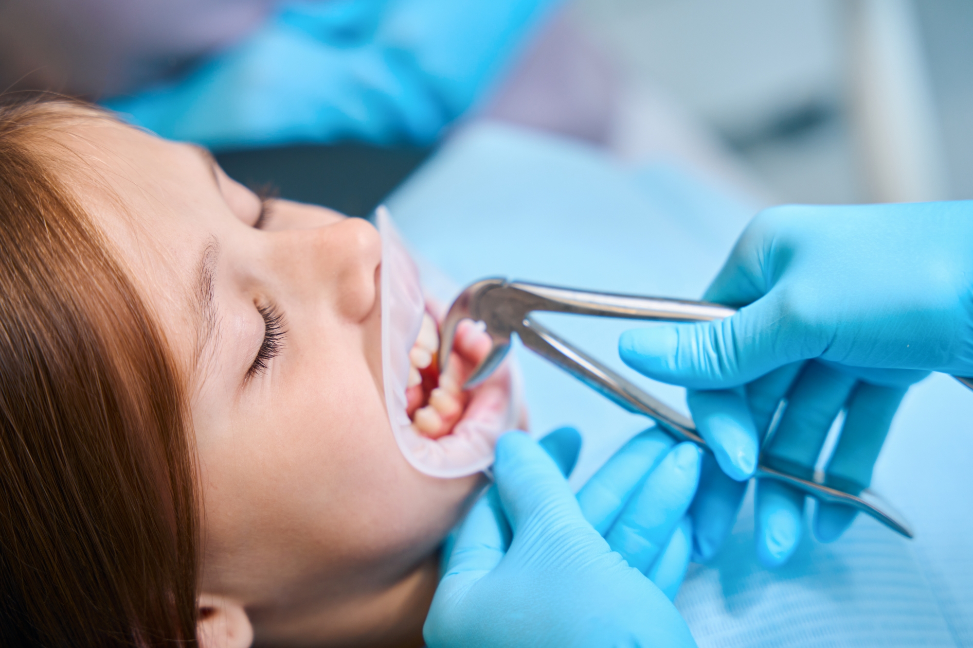 Child undergoing tooth extraction at the dentist at a Premier Oral and Maxillofacial Surgery Group Clinic.