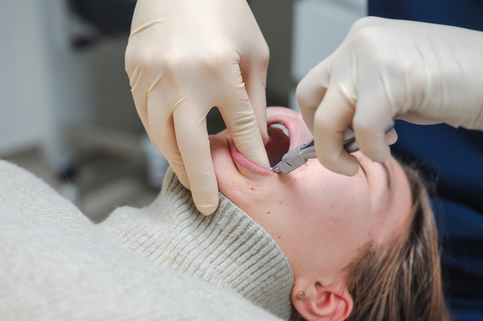 Close-up shot of a dental procedure at Premier Oral.
