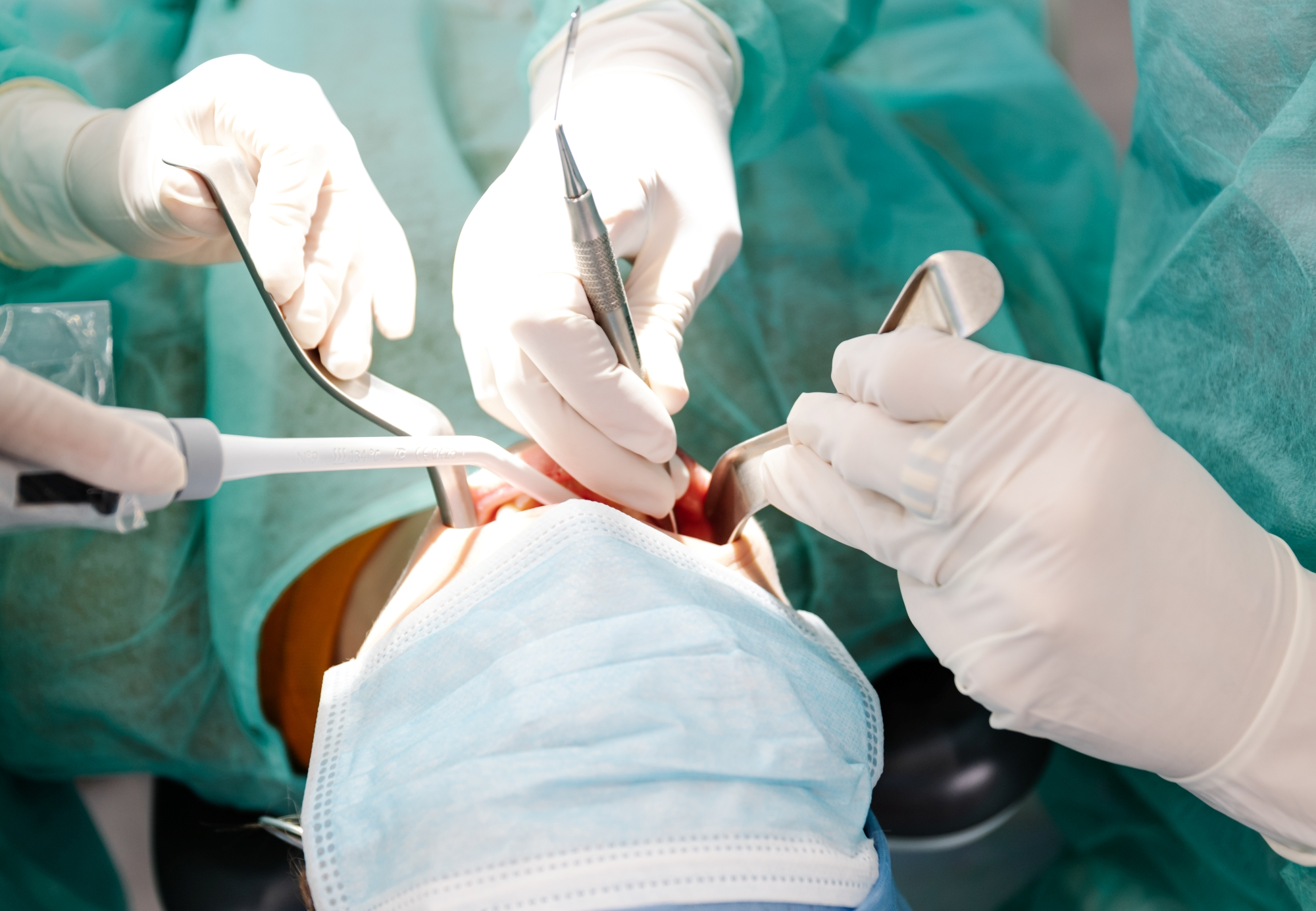 Dentists performing an oral surgery for the patient at a Premier Oral and Maxillofacial Surgery Group Clinic.