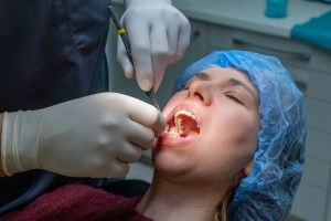 A woman receiving her routine dental check-up at Premier Oral.