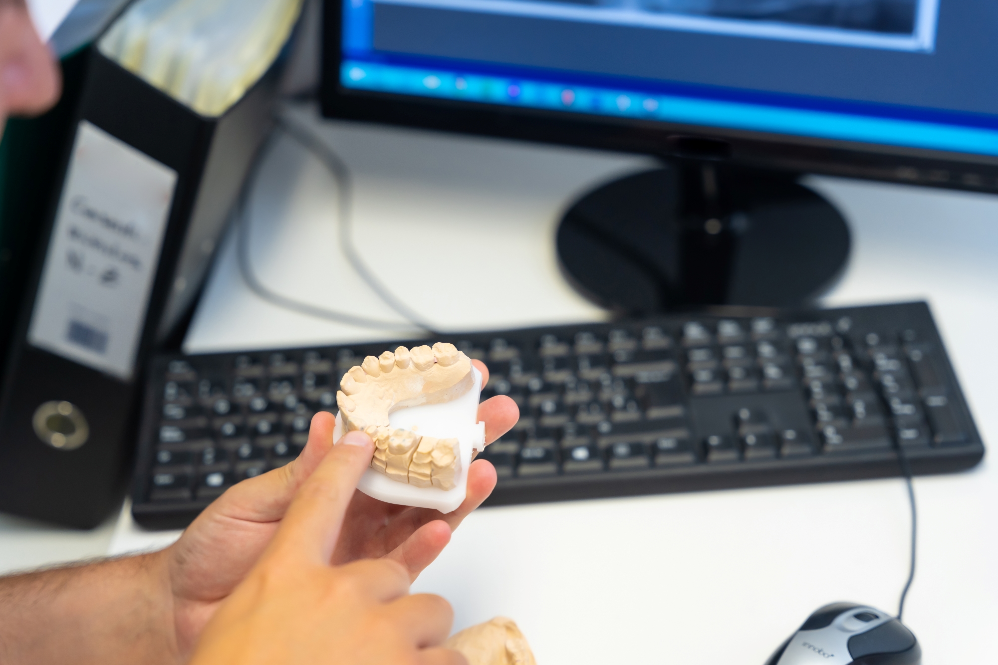 Hand holding dental mold in front of the computer at Premier Oral and Maxillofacial Surgery Group.