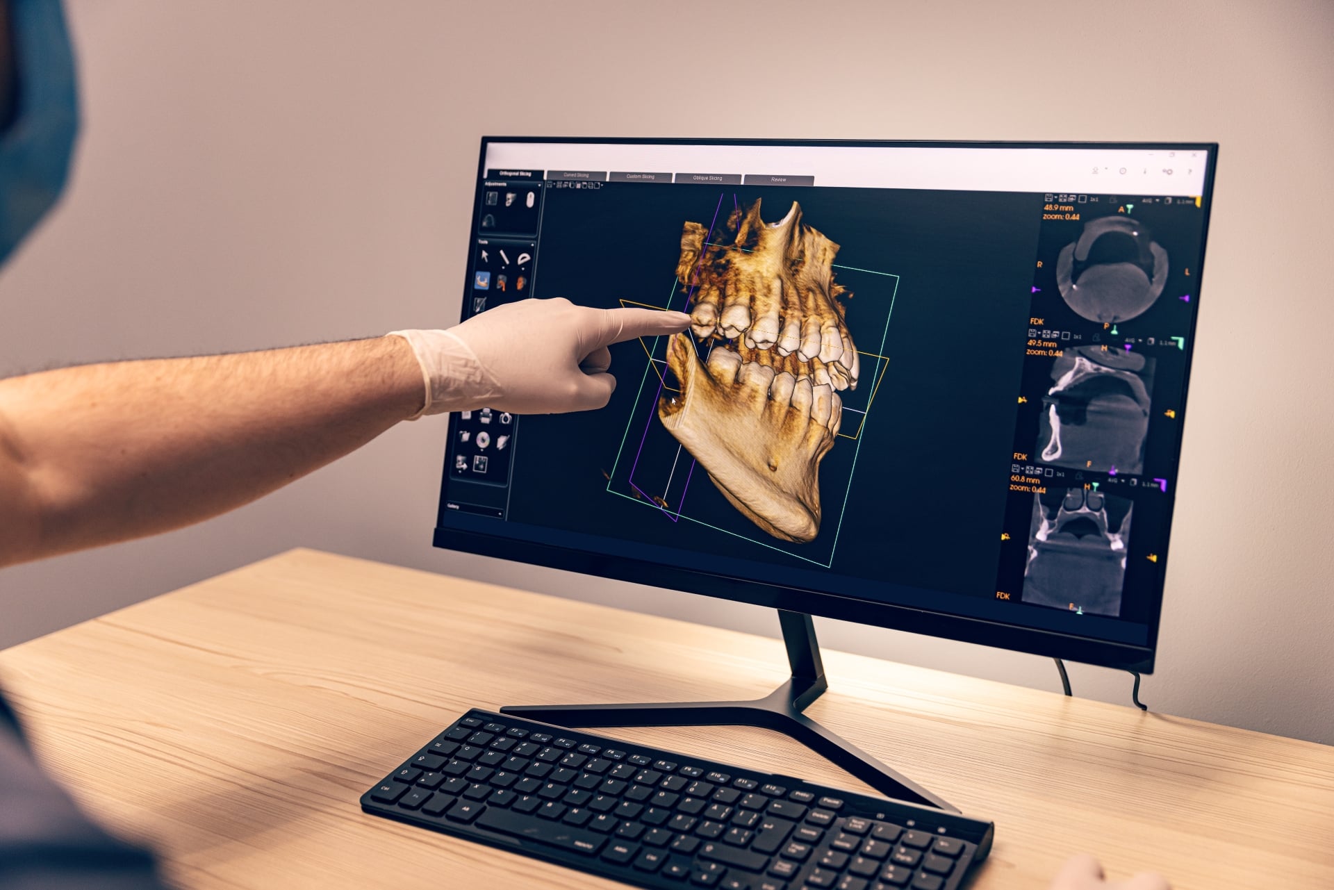  Oral surgeon reviewing 3D jaw scan on screen for orthognathic surgery planning at Premier Oral. 