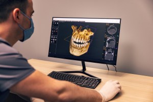 Oral surgeon reviewing 3D jaw scan for dental implant and bone graft treatment planning at Premier Oral.