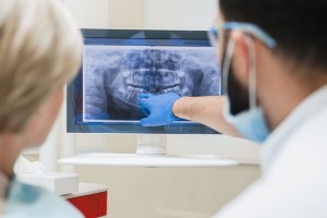 Oral surgeon reviewing panoramic jaw X-ray with patient during maxillofacial consultation at Premier Oral.