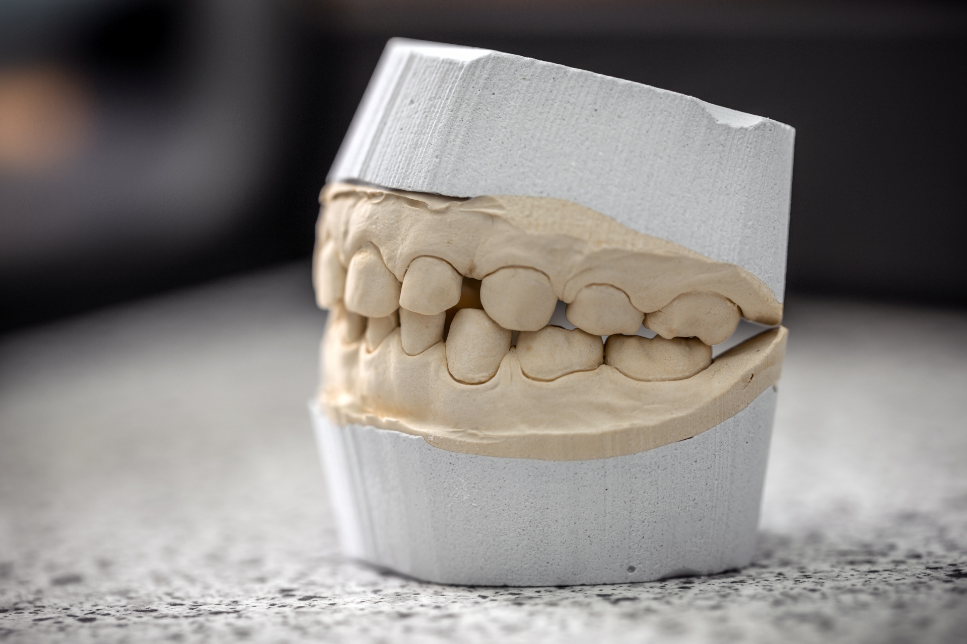 Oral surgeon reviewing 3D jaw scan for dental implant planning in a clinical setting.