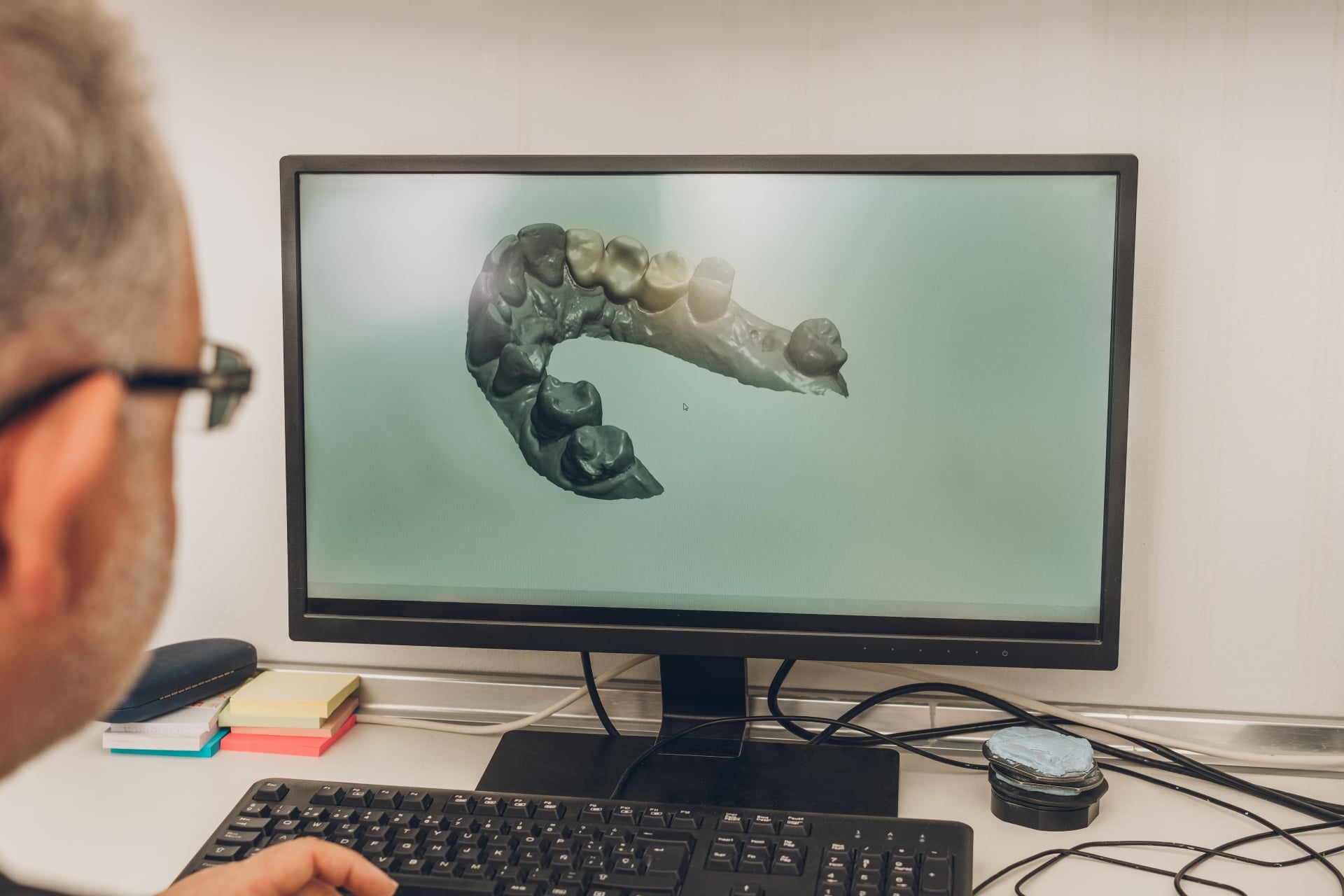 Premier Oral specialist reviews a detailed 3D dental jaw scan on a computer monitor.