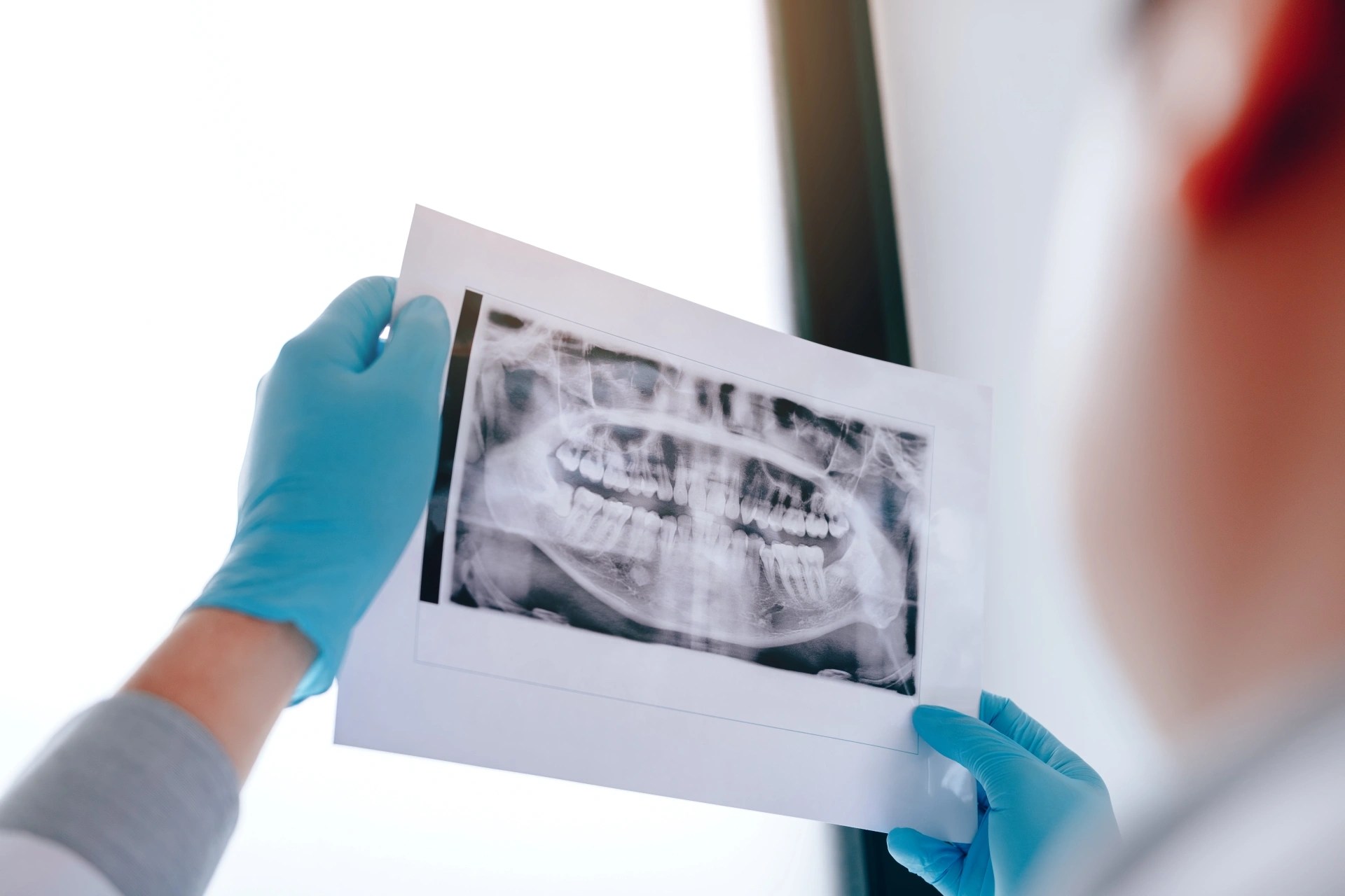 Premier Oral’s specialist holding up a panoramic dental X-ray film for analysis.