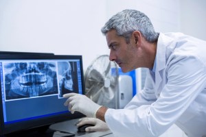 Oral surgeon reviewing dental imaging to assess implant candidacy.