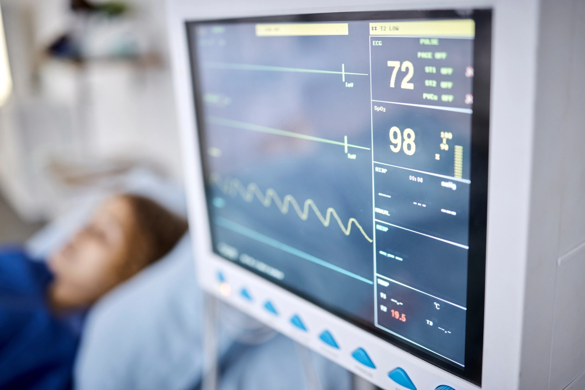 Medical monitor displaying a patient’s vital signs during monitored oral surgery sedation.