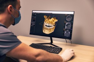Oral surgeon reviewing a 3D dental scan at Premier Oral.